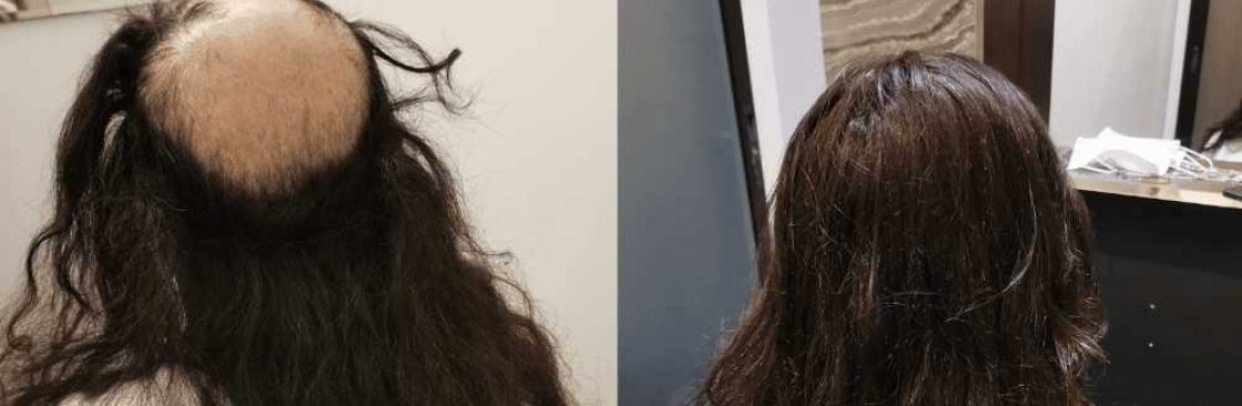 Hair Replacement SG Cover Image