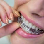 average cost of invisalign braces Profile Picture